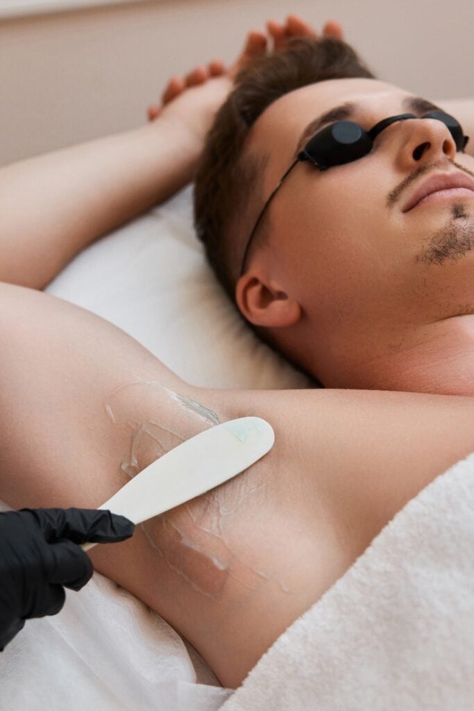young man undergoes procedure of arm pit laser epilation