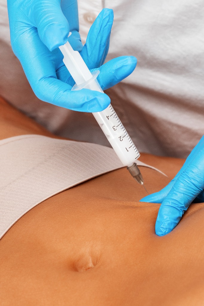 Ästhetische Kosmetikerin führt lipolytische Injektionen durch, um Fett am Körper einer Frau zu verbrennen. Ästhetische Kosmetologie für Frauen in einem Schönheitssalon - Kosmetologiekonzept.