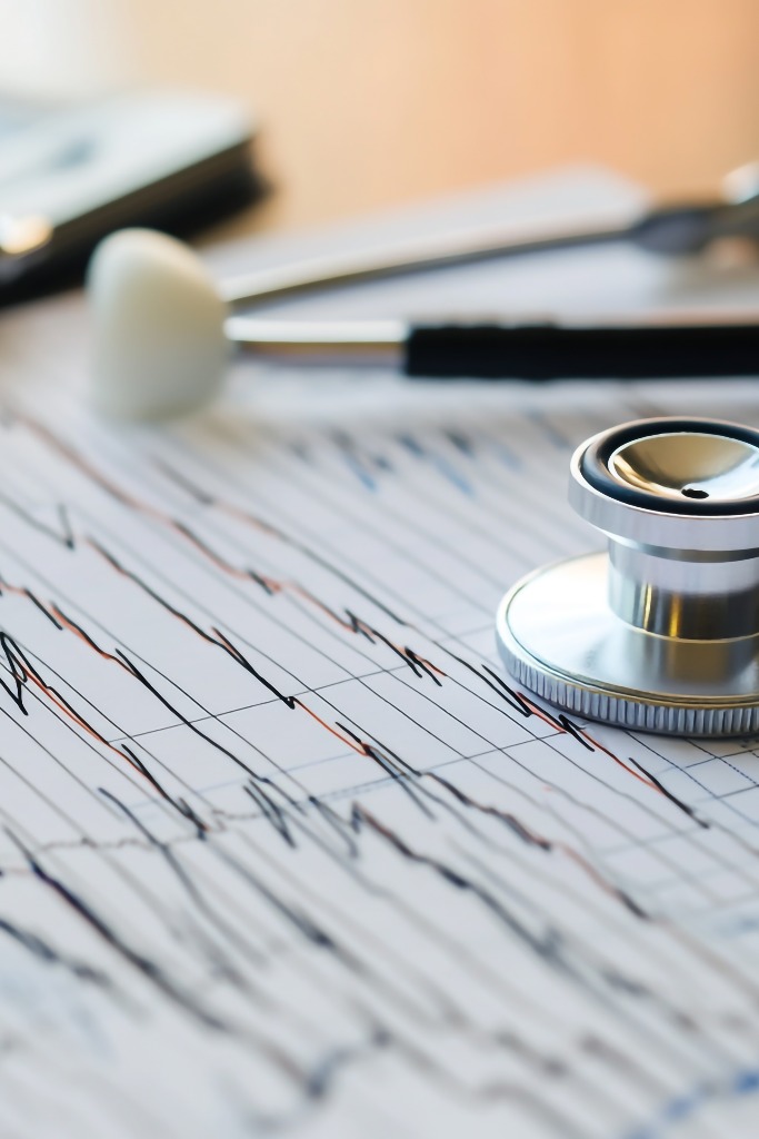 Eine schwarze schlanke Linie EKG-Grafikqualität und schlanke Wertgrafiken auf einem EKG-Grafikpapier